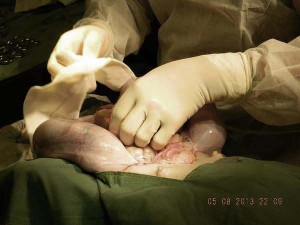 5Chrisella_Kneen_Caesarian_6th_August_032